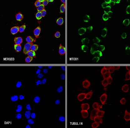 MTCO1 Recombinant Rabbit mAb (S-2205-28)