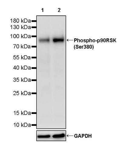 Phospho-p90RSK (Ser380) Recombinant Rabbit mAb (S-4985)