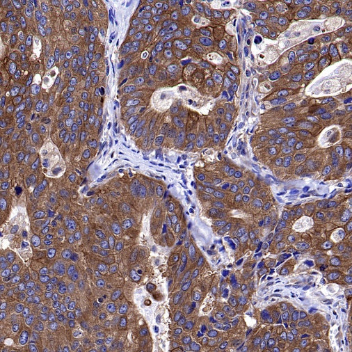 Atg5 Recombinant Rabbit mAb (S-3181)