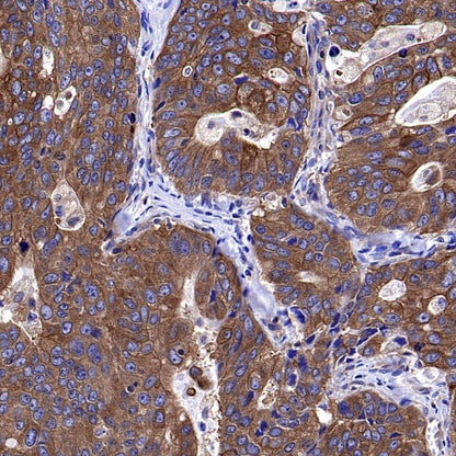 Atg5 Recombinant Rabbit mAb (S-3181)