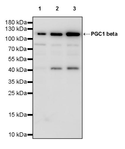 PGC1 beta Recombinant Rabbit mAb (S-1212-146)
