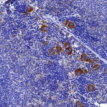 TGF beta 1 Recombinant Rabbit mAb (S-3204)