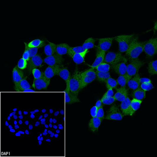 Beta III tubulin Recombinant Rabbit mAb (Alexa Fluor® 488 Conjugate) (SDT-251-28)