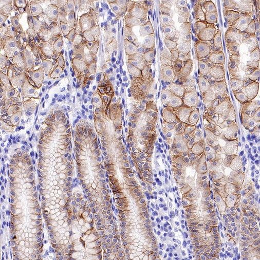 Integrin beta 6 Recombinant Rabbit mAb (SDT-1445-78)