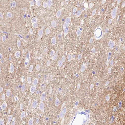 Versican Recombinant Rabbit mAb (S-3770-43)