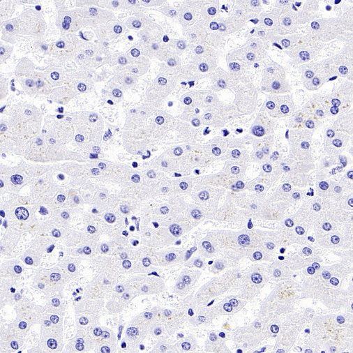CD44v6 Mouse mAb (S-945-76)