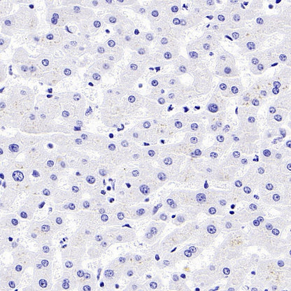 CD44v6 Mouse mAb (S-945-76)
