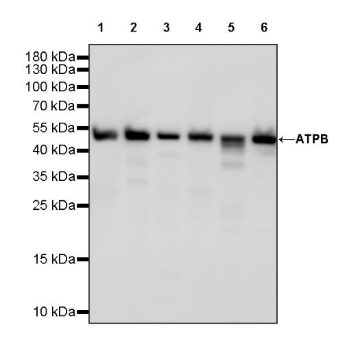 ATPB Rabbit Polyclonal Antibody
