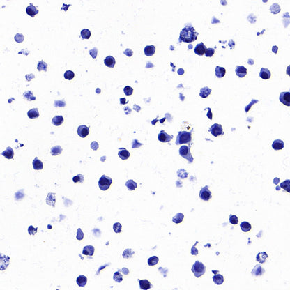 STEAP1 Recombinant Rabbit mAb (S-3613-107)