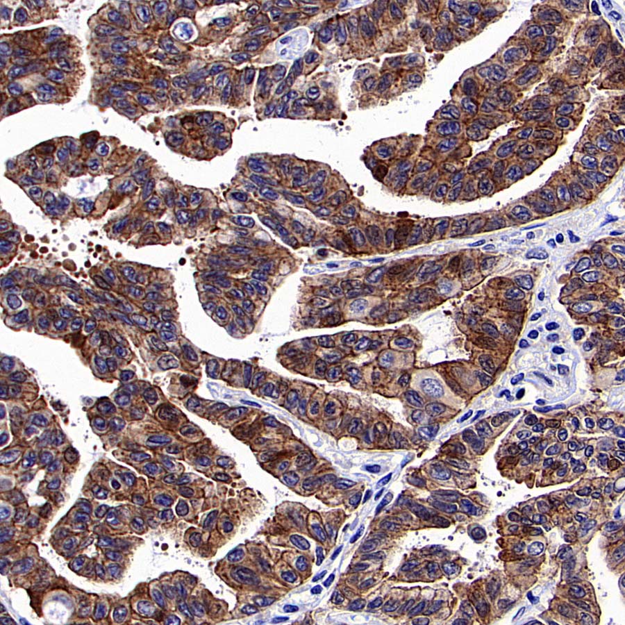 KLHL21 Recombinant Rabbit mAb (S-3460-252)
