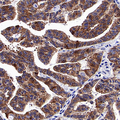 KLHL21 Recombinant Rabbit mAb (S-3460-252)