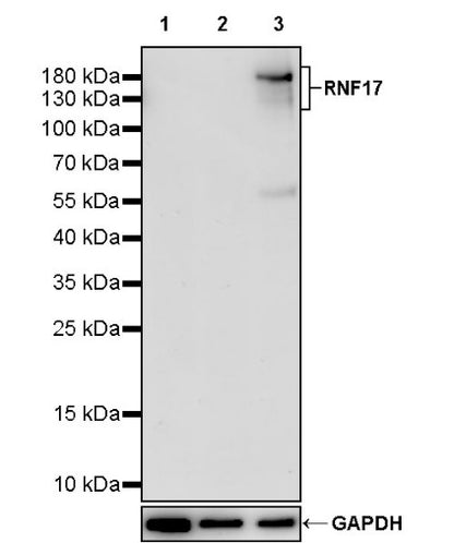 RNF17 Recombinant Rabbit mAb (S-3660-61)