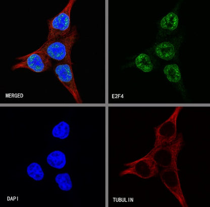 E2F4 Recombinant Rabbit mAb (S-586-214)