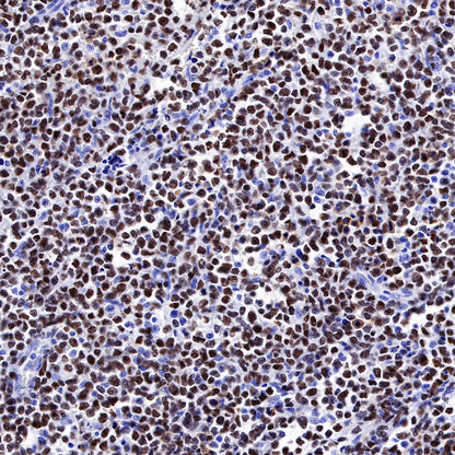 S-RMab® p53 Recombinant Rabbit mAb (SDT-R118)
