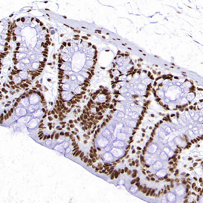 Rad21 Recombinant Rabbit mAb (S-M0006)