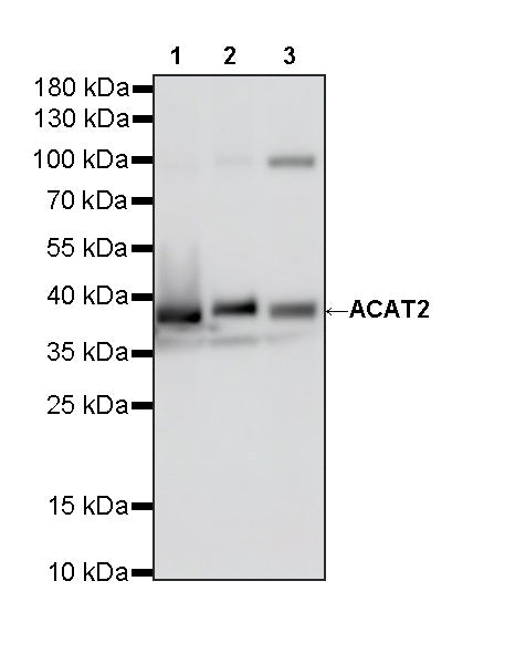 ACAT2 Recombinant Rabbit mAb