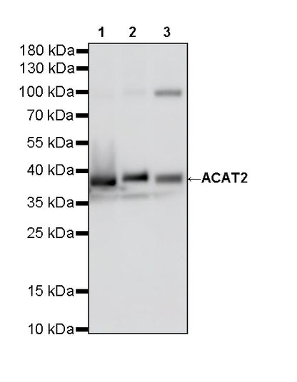 ACAT2 Recombinant Rabbit mAb