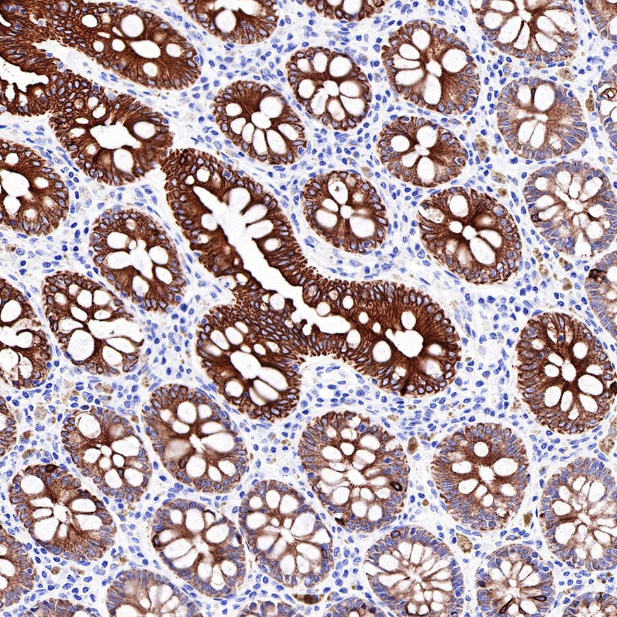 CK-LMW Recombinant Rabbit mAb (SDT-P003)