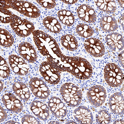 CK-LMW Recombinant Rabbit mAb (SDT-P003)