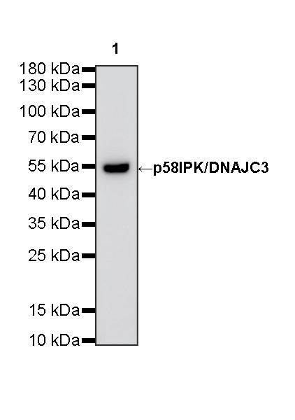 p58IPK/DNAJC3 Recombinant Rabbit mAb (S-4816-205)