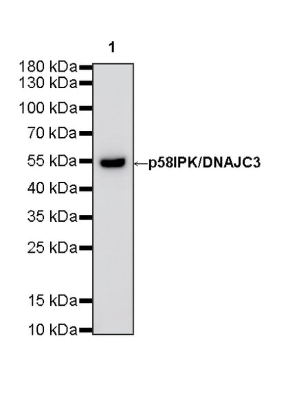p58IPK/DNAJC3 Recombinant Rabbit mAb (S-4816-205)