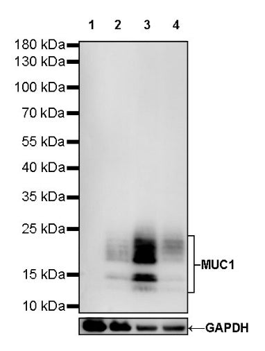 S-RMab® MUC1/EMA Recombinant Rabbit mAb (SDT-776-49)