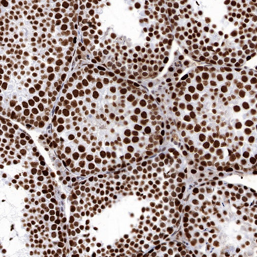 PARP1 Recombinant Rabbit mAb (S-R299)