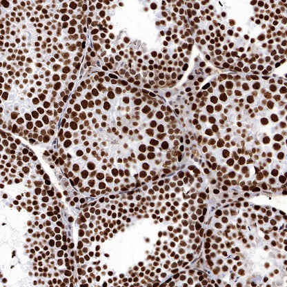 PARP1 Recombinant Rabbit mAb (S-R299)