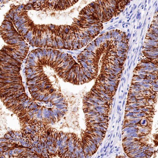 Claudin 1 Recombinant Rabbit mAb (SDT-1289-55)