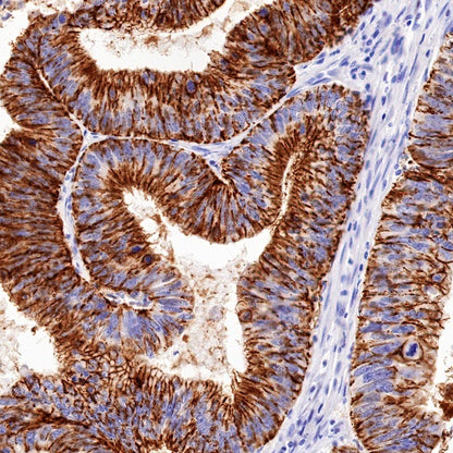 Claudin 1 Recombinant Rabbit mAb (SDT-1289-55)