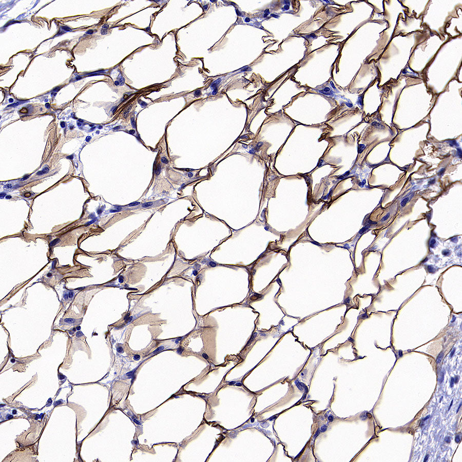 PNPLA2 Recombinant Rabbit mAb (S-5409)