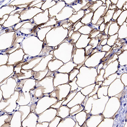 PNPLA2 Recombinant Rabbit mAb (S-5409)