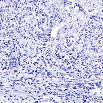 Myelin protein zero Recombinant Rabbit mAb (SDT-1225-8)