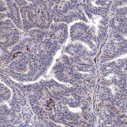 PTEN Recombinant Rabbit mAb (SDT-R074)
