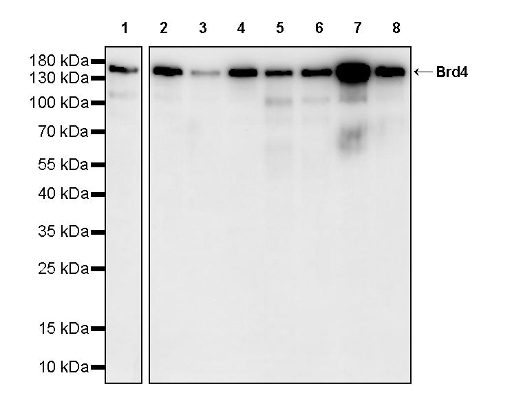 Brd4 Recombinant Rabbit mAb (S-5145)