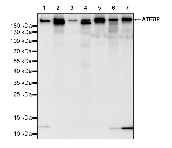 ATF7IP Recombinant Rabbit mAb (S-4081-25)