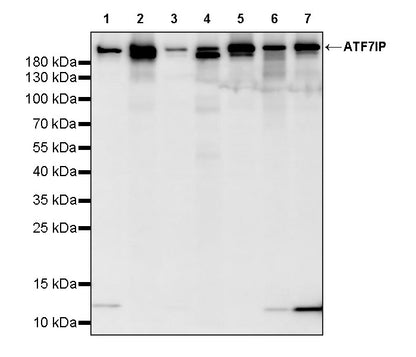 ATF7IP Recombinant Rabbit mAb (S-4081-25)