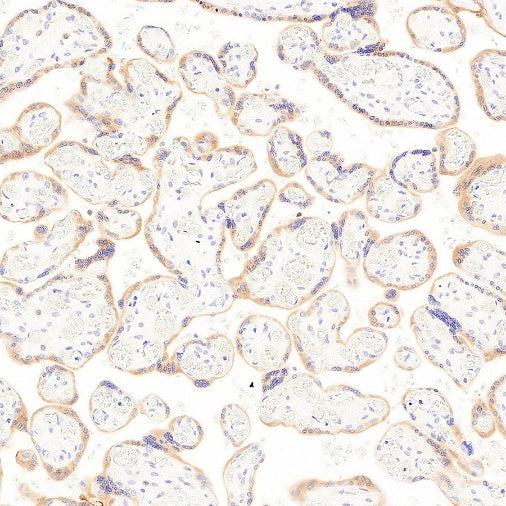 LPCAT1 Recombinant Rabbit mAb (S-6053)