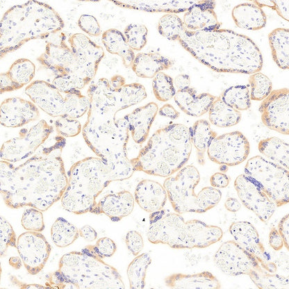 LPCAT1 Recombinant Rabbit mAb (S-6053)