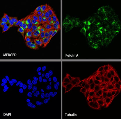 Fetuin A Recombinant Rabbit mAb (S-1109-5)