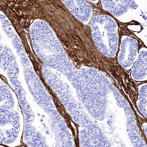 Collagen I Recombinant Rabbit mAb (S-1473-5)