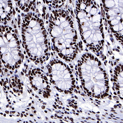 ARID1A Recombinant Rabbit mAb (S-440-62)