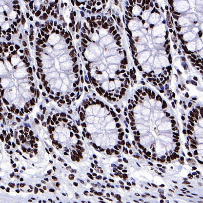 ARID1A Recombinant Rabbit mAb (S-440-62)