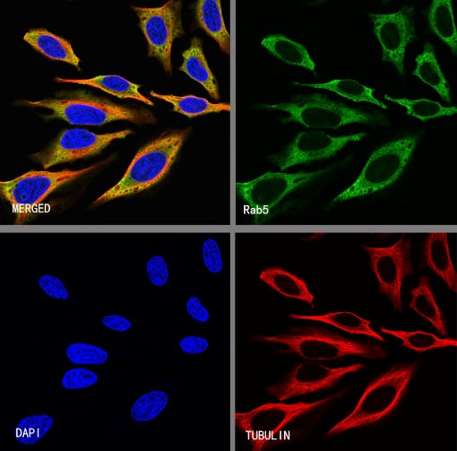 Rab5 Recombinant Rabbit mAb (S-1506-128)