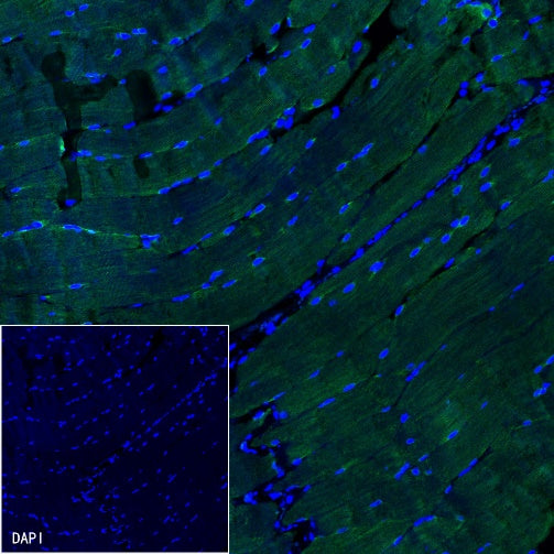 S-RMab® Desmin Recombinant Rabbit mAb (SDT-109-114)