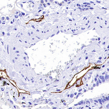 Podoplanin (D2-40) Recombinant Rabbit mAb (SDT-1178-8)