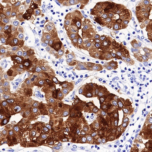 ACSL4/FACL4 Recombinant Rabbit mAb (S-461-6)