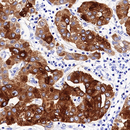 ACSL4/FACL4 Recombinant Rabbit mAb (S-461-6)
