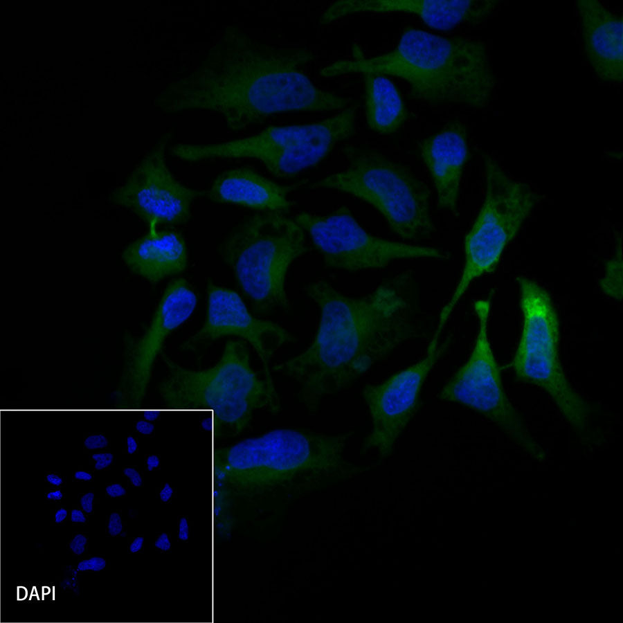β-tubulin Recombinant Rabbit mAb (FITC Conjugate) (SDT-R014)