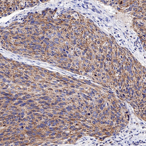 MCL1 Recombinant Rabbit mAb (S-772-109)
